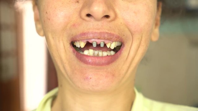 Girl with ugly teeth smile