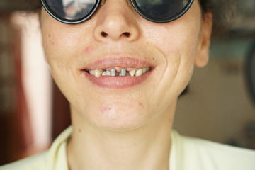 Ugly toothless young woman smiling