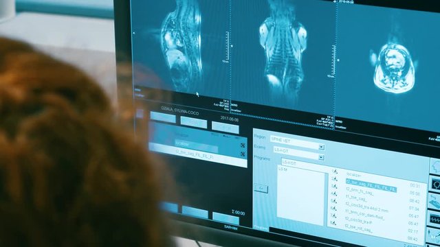 Live monitoring of x-ray results at the vet hospital, close up shot