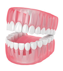 3d render of jaw with teeth over white