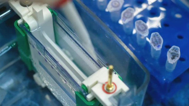 Scientific experiment with human DNA. A scientist uses a thin pipette to place samples with DNA fragments on an agarose gel to separate DNA fragments.