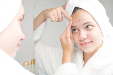 girl in a white robe squeezes acne on the forehead with her hands in the bathroom in front of the mirror