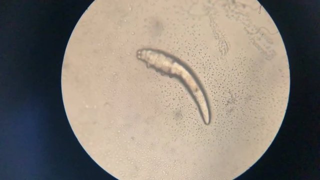 Mite in microscope