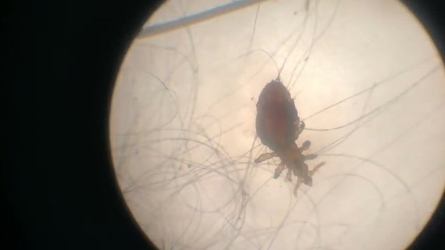 Mite in microscope