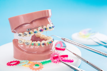 Dentist tools and orthodontic model on blue background.