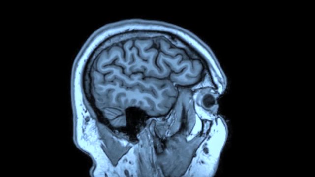 Slow-motion loop of a brain scan of a healthy human adult male caucasian FMRI right to left ear to ear