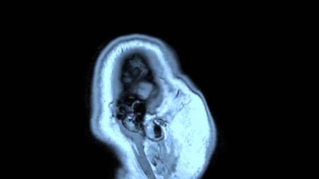 Loop of a brain scan of a healthy human adult male caucasian FMRI right to left ear to ear