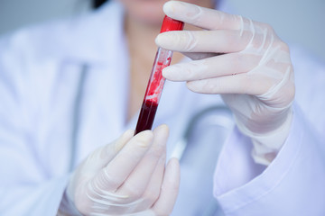 Selective focus hand of a doctor holding a bottle of blood