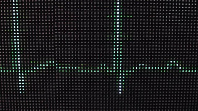 Green electrocadiogram signals on graph background. Human heartbeats