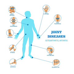 Joints diseases infographic banner vector illustration infographic design