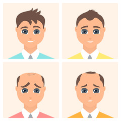 Hair loss stages set of four steps. Front view of a man losing hair. Male alopecia pattern. Medical infographics. Health and beauty concept. Vector illustration made in cartoon style.