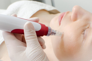 Cosmetologist,beautician in white gloves applying facial dermapen treatment on face of young girl customer in beauty salon.Cosmetology and professional skin care, back side view 