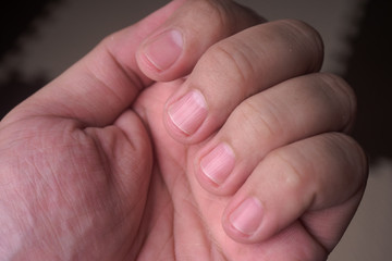 Obraz na płótnie Canvas close up of an asian men finger nail 