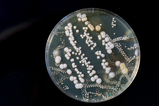 petri dish with bacteria, isolated on black