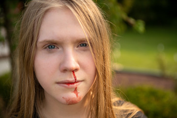 Young woman with a bloody nose