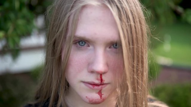Young woman with a bloody nose