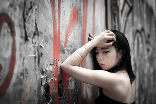 苦悩と向き合う人物 リストカットの跡がある美しい日本人女性 Stock 写真 Adobe Stock