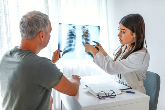 Doctor and patient looking at Xray in medical office. Doctor shows the patient chest x-ray. Doctor and patient looking at chest x-ray together. Doctor talking with female patient in doctors office...
