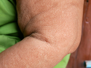 Close-up skin of an elderly woman.