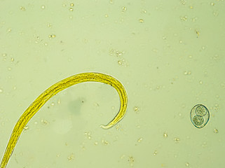 Aelurostrongylus abstrusus larva and Isospora spp. oocyst under the microscope
