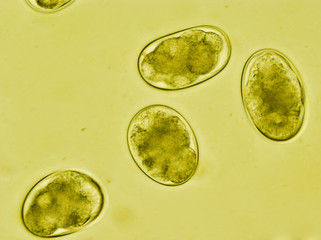 Strongyle eggs under the microscope, Uncinaria/Ancylostoma, hookworm from cat feces