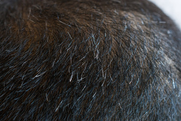Cropped shot view of Asian men head with few grey hair growing. Hair turns white when the pigmentation cells responsible for colour (melanin) stop being produced.