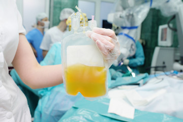 medical container with plasma in the hands of a nurse on the background of a surgical operation