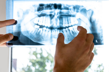 doctor examines x-ray picture of human jaw