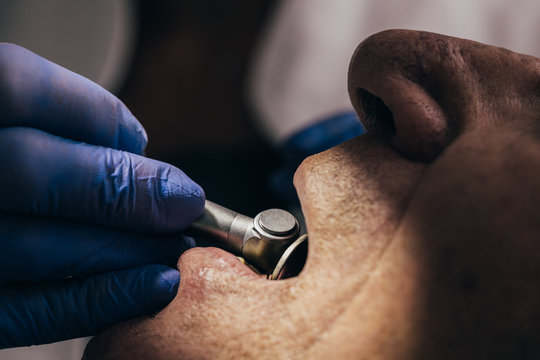 Dentist working on elderly man teeth