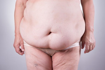 Tummy tuck, flabby skin on a fat belly, plastic surgery concept