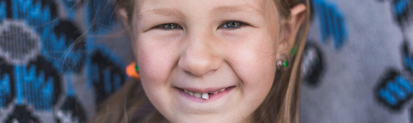 Obraz premium Dairy tooth fell out of the child. Little girl wobble loose tooth