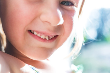 Fototapeta premium Portrait of a little girl with a wobbly baby tooth