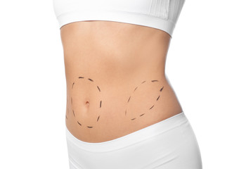 Young woman with marks on body for cosmetic surgery operation against white background, closeup