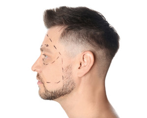 Obraz premium Man with marks on face for cosmetic surgery operation against white background
