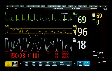 EKG Monitor Elektrokardiogramm mit verschiedenen Anzeigen des menschlichen Kreislaufes