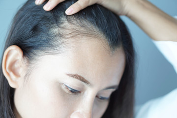 Woman looking reflection in the mirror serious hair loss problem for health care shampoo and beauty...