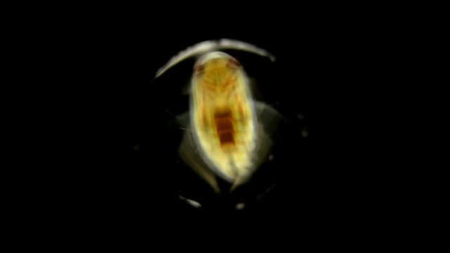 adult larva of the water bug Notonecta glauca under a microscope, lives mainly in ponds and rivers, can fly, does it at night, is a predator, the larva feeds on plankton, and an adult can even attack