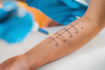 Allergy Testing © Microgen