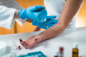 Immunology Doctor Measuring Allergic Reaction of Patient