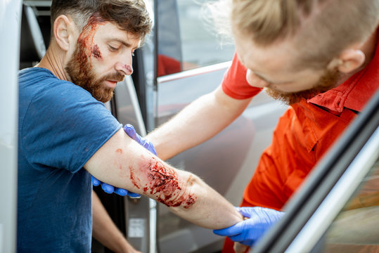 Ambulance worker examining deep arm injuries of a man sitting near the car after the road accident, providing emergency medical assistance