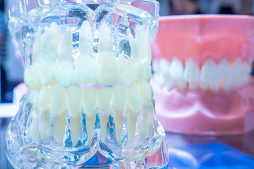 Artificial teeth models. The models of the jaw. Jaw layouts. Dental modeling. Prosthetic dentistry. Printing of dental prostheses on a 3D printer. Denture.