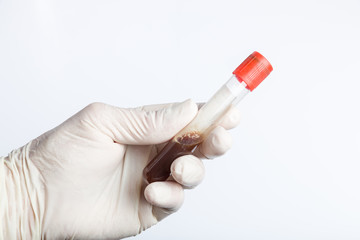Doctor's hand with medical glove holding a blood probe