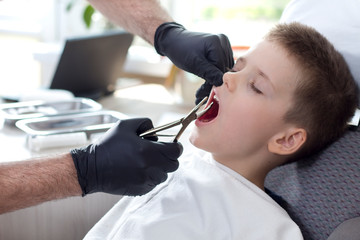 Gabinet dentystyczny. Wyrywanie mlecznego zęba. Chłopiec siedzi na fotelu dentystycznym. Dentysta w czarnych gumowych rękawiczkach trzyma kleszcze do wyrywania zębów.