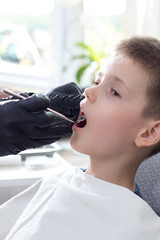 Ręce dentysty w jednorazowych czarnych gumowych rękawiczkach trzymają lusterko dentystyczne....