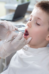 Chłopiec w wieku szkolnym podczas przeglądu uzębienia w gabinecie stomatologicznym. Dłonie dentysty w białych rękawiczkach trzymają ekskawator i lusterko dentystyczne. - obrazy, fototapety, plakaty