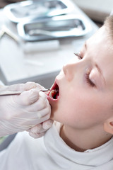 Chłopiec w wieku szkolnym podczas przeglądu uzębienia w gabinecie stomatologicznym. Dłonie dentysty w białych rękawiczkach trzymają ekskawator - obrazy, fototapety, plakaty
