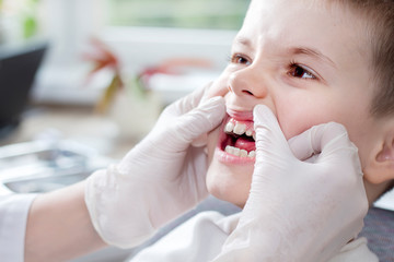 Sprawdzanie stanu zębów u dziecka. Dłonie lekarza w białych rękawiczkach przesuwają dziąsła i odsłaniają  białe zęby chłopca.  - obrazy, fototapety, plakaty