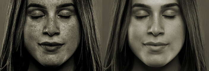 A side by side comparison showing the before and after results of a young girl who spent too long...