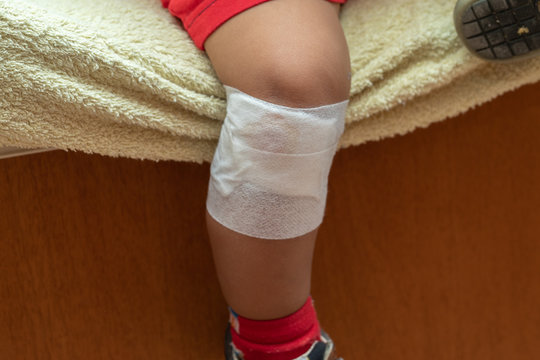 A Closeup View On The Leg Of A Young Boy With A Large Bandage Wrapped Around The Knee. Slight Weeping Can Be Seen Through The White Gauze From A Fresh Injury.