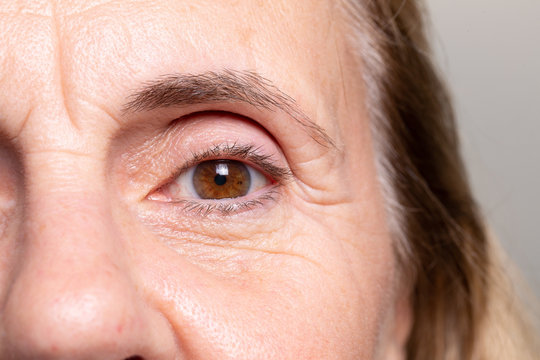 An Extreme Closeup View On The Eye Of An Elderly Woman With Brown Iris. Heavy Wrinkles And Laughter Lines Are Seen Around The Thinning Skin.